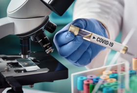      ÜST:   Koronavirusa rekord yoluxma qeydə alındı  