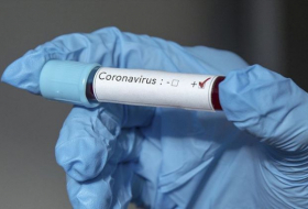    44 min 212 nəfər koronavirusdan ölüb  -    STATİSTİKA     