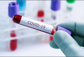 Dünyada 50-dən çox jurnalist koronavirusdan ölüb 