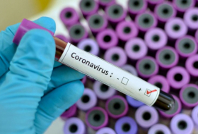 Ermənistanda 40 nəfər koronavirusdan ölüb 