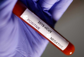  Rusiyada koronavirus xəstələrinin sayı artır 