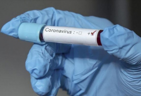  Dünyada koronavirusa yoluxma kəskin artır 