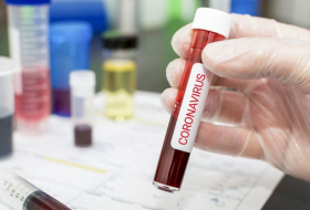 Rusiyada daha 577 nəfər koronavirusdan öldü  
