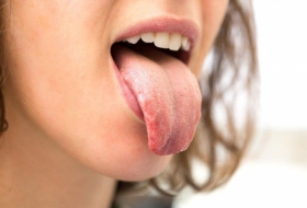    Dilin rəngi hansı xəstəliklərdən xəbər verir?  
   